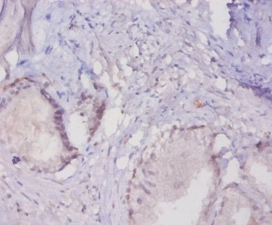 Mucin6 Polyclonal Antibody