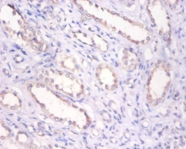 Bone morphogenetic protein 6 Polyclonal Antibody