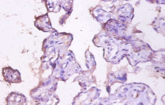 Mucin Polyclonal Antibody
