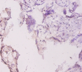 Laminin subunit gamma Polyclonal Antibody