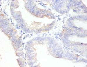 Antigen KI-67 Polyclonal Antibody