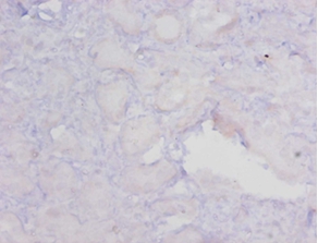 Methylated-DNA--protein-cysteine methyltransferase Polyclonal Antibody