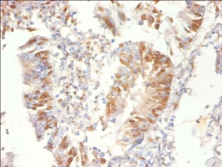 Proteasome activator complex subunit 3 Polyclonal Antibody