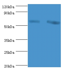 60 kDa SS-A/Ro ribonucleoprotein Polyclonal Antibody