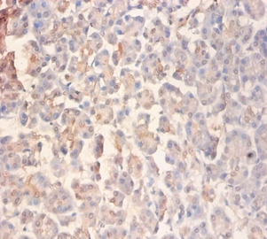 Glutamate receptor ionotropic, NMDA 2A Polyclonal Antibody