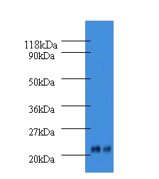 Alpha-acid glycoprotein 2 Polyclonal Antibody
