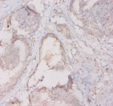 HLA class II histocompatibility antigen, DQ alpha 2 chain Polyclonal Antibody