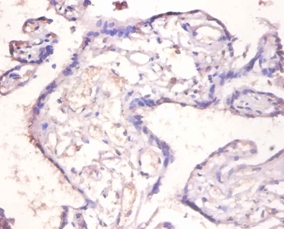 Interleukin8-binding Polyclonal Antibody