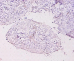 MetallothioneinE Polyclonal Antibody