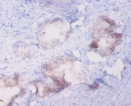 MetallothioneinA Polyclonal Antibody