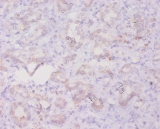 Transforming growth factor beta-3 Polyclonal Antibody