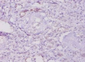 Phosphatidylinositol 3,4,5-trisphosphate 3-phosphatase and dual-specificity protein phosphatase PTEN Polyclonal Antibody