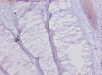 Collagen alpha(XVII) chain Polyclonal Antibody