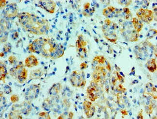 AMY1A Polyclonal Antibody