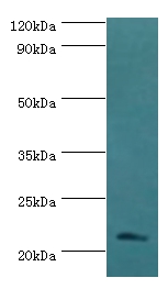 SSX2 Polyclonal Antibody