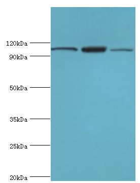 EFTUD2 Polyclonal Antibody