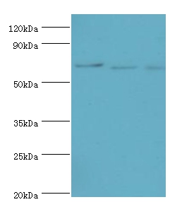 CDC16 Polyclonal Antibody