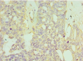 HYAL1 Polyclonal Antibody
