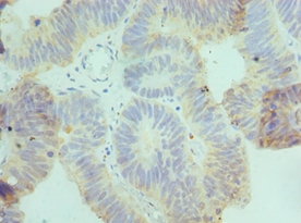 CSRNP1 Polyclonal Antibody