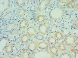 BCL7C Polyclonal Antibody