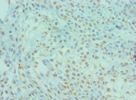 DYRK2 Polyclonal Antibody