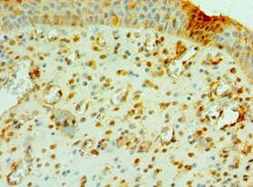 CNOT8 Polyclonal Antibody