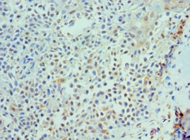 IL21 Polyclonal Antibody