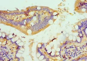 CSRP2BP Polyclonal Antibody