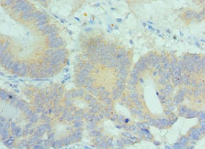 PLK2 Polyclonal Antibody
