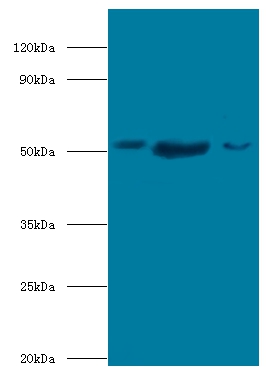 BAG family molecular chaperone regulator 5 Polyclonal Antibody