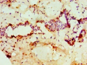 Protein-arginine deiminase type-2 Polyclonal Antibody