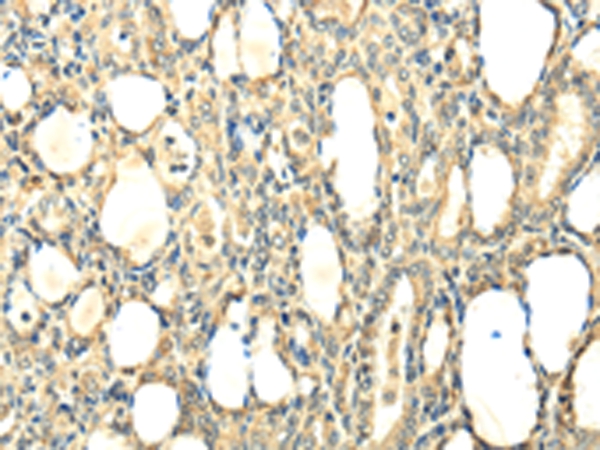 CCL25 Antibody