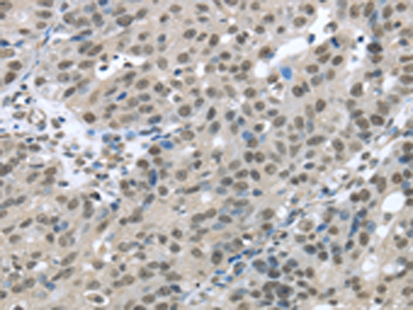 HDAC1 Antibody