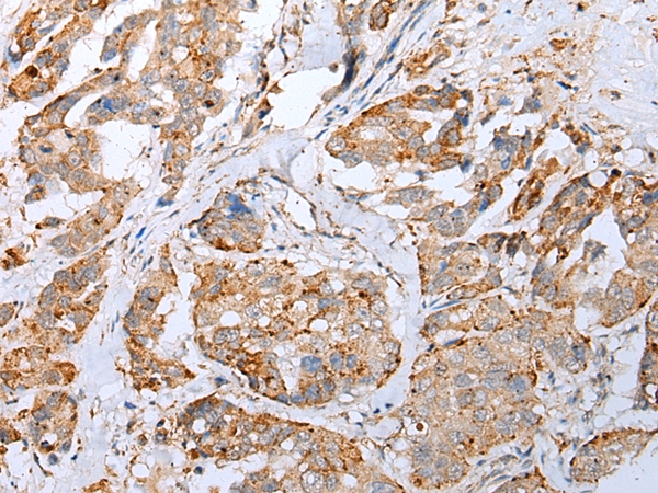 IL6 Antibody