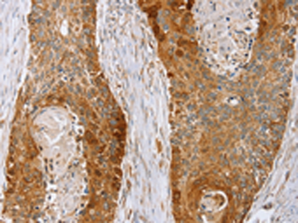 LMO4 Antibody