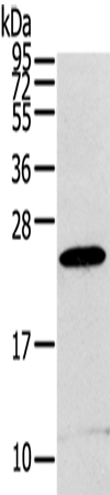 RGS1 Antibody
