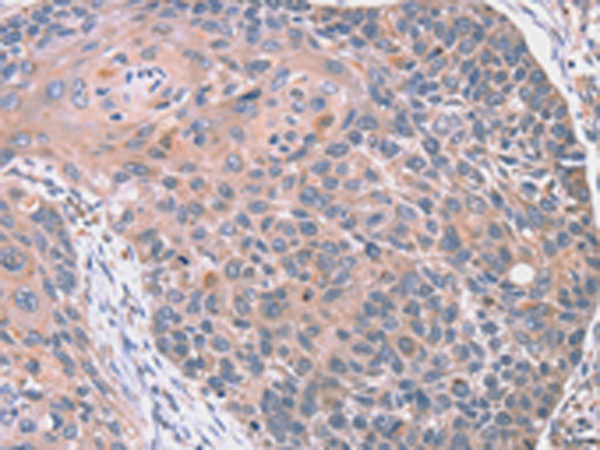 RGS10 Antibody