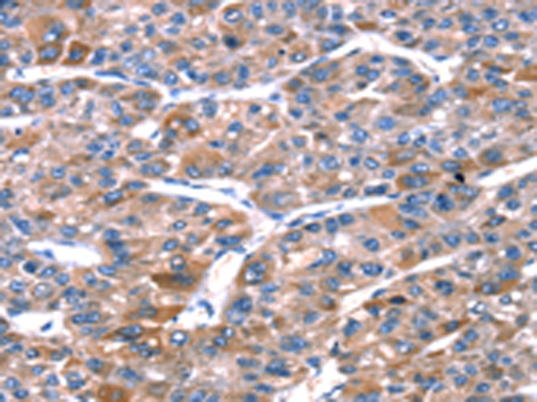 RPL11 Antibody