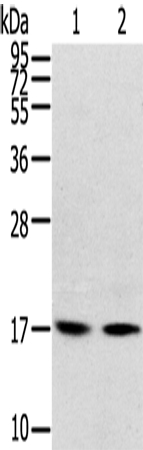 RPLP1 Antibody