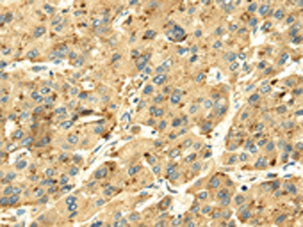 SENP2 Antibody