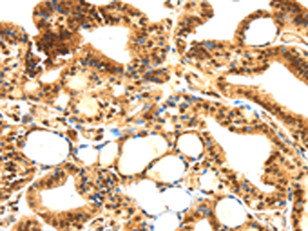 SERPINB1 Antibody