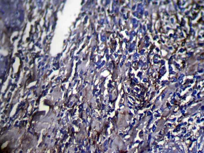 SERPINB6 Antibody