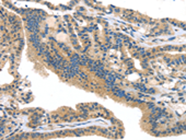 SMYD3 Antibody