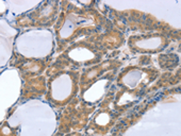 SNX4 Antibody