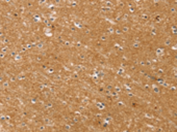 SYTL5 Antibody