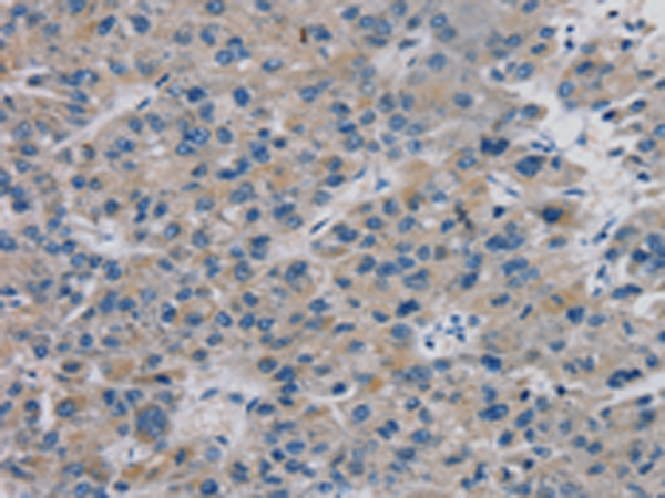 TBX18 Antibody