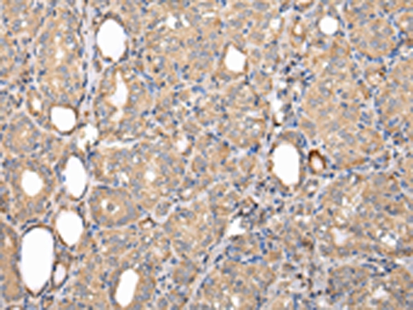 SERPINA7 Antibody