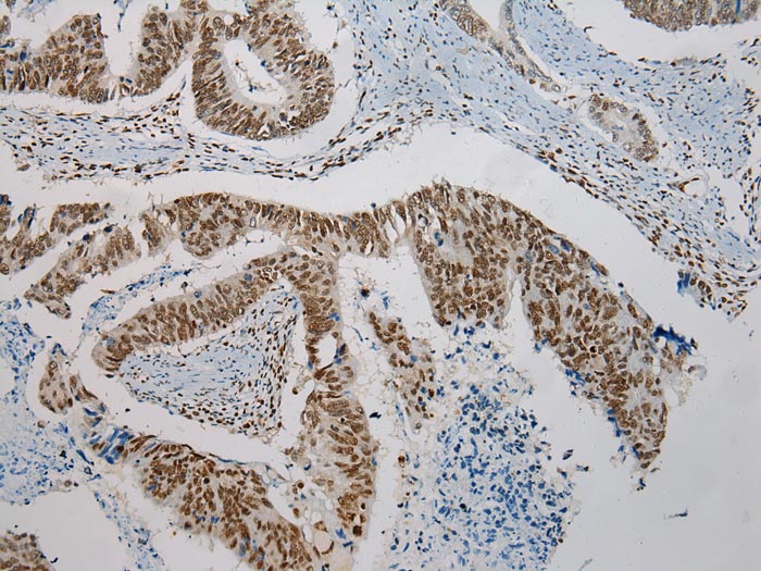 TRPC4AP Antibody