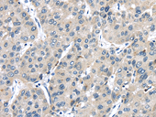TRPM2 Antibody