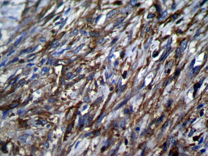 TSSC1 Antibody
